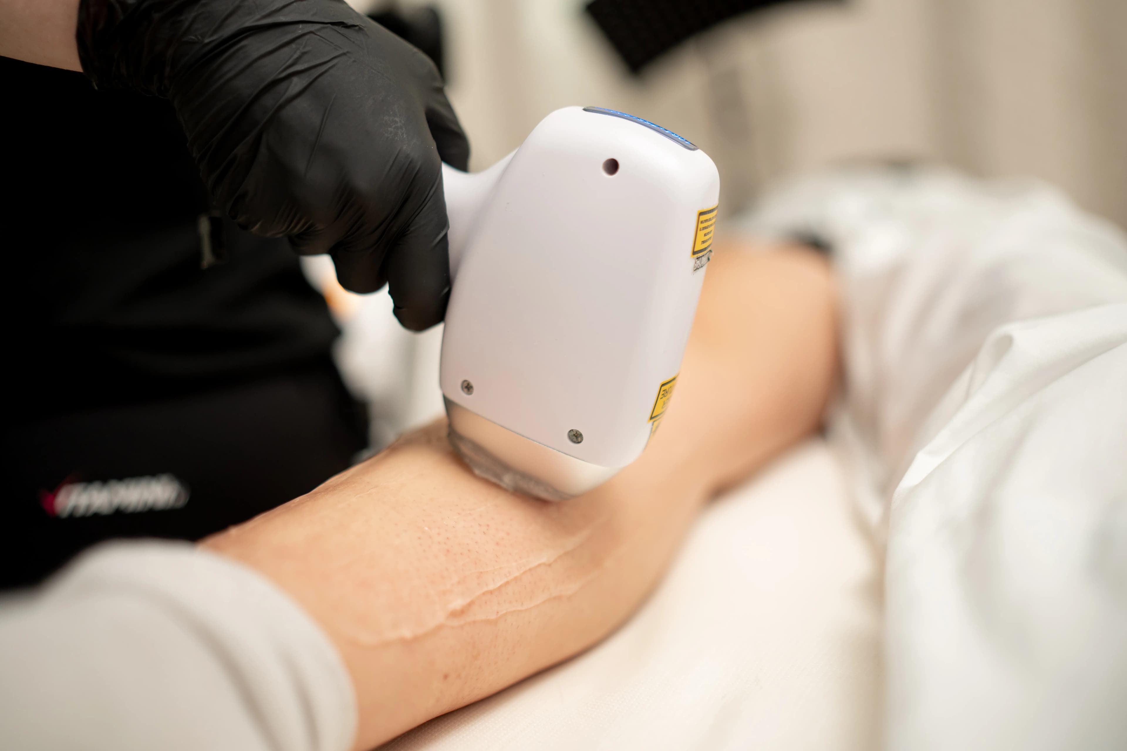 Diodni laser